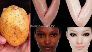 Just One Potato 🥔 More Powerful Than Expensive Creams! Brightens Skin & Reduces Wrinkles