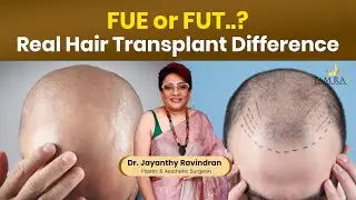 FUE или FUT? | Какая пересадка волос подходит вам лучше всего? | Tamira Life | Ченнаи
