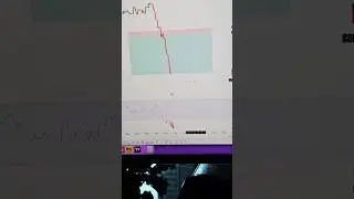 Today Live Trades In VIP Traders Room