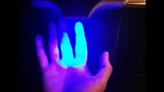 Hands, infection, and the microbial community