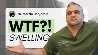 WTF?! Why Am I So Swollen After Surgery? | Dr. Benjamin Explains