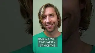 Hair Growth Time Lapse - 1 Year & 5 Months