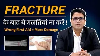 Fracture में पहले 5 Minute में क्या करें। FIRST 5 MINUTES Matter। Dr. Pratik Gandhi
