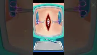 ASMR Cupping therapy and back massage for pain relief | Hijima treatment animation