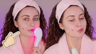 THE BEST SKINCARE TOOLS FOR ACNE PRONE SKIN
