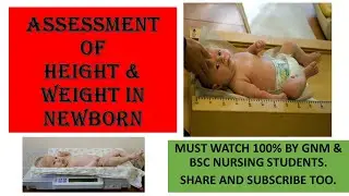 Assessment of weight and height in children