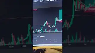 Stoploss is part of game Learn trading with discipline. Losses are temporary, skills are permanent.