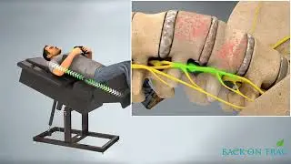 Eliminate Back Pain, Sciatica and Disc Bulges with Back on Trac | Walton Clinic of Chiropractic