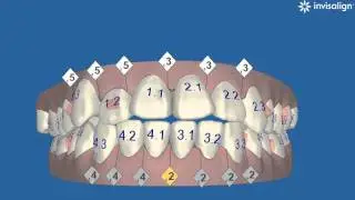 Engstand -  Expansion & ASR.wmv