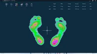 Foot Pressure Distribution System