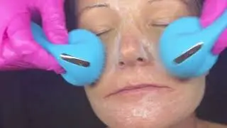 Melissa Rivera Pigmentation Video 4