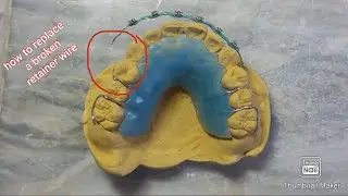 How to Replace a broken retainer wire