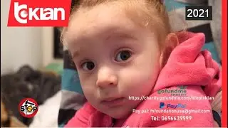 Humanizem/ Shqiptare nga e gjithe bota bejne te mundur operimin e Noemit - Stop - 30 Mars 2021