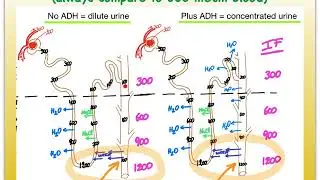 7O Urinary Dilute vs Concentrated Urine