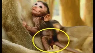 Why! Why! Baby David feel Cry till red face when d0 this in chest mother Diamond.
