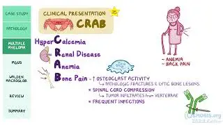Plasma Cell Disorders | Hematology | Osmosis Pathology Review