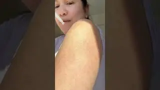 Remove strawberry skin in seconds w/ Dr Melaxin peel shot duo
