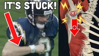 WORST NFL SHOULDER INJURY? Doctor Explains why DREW BREES can't THROW