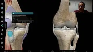 Capsula rodilla: Oseo, musculo, ligamento y meniscos mediante RM