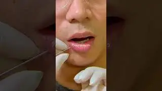 Labret Piercing