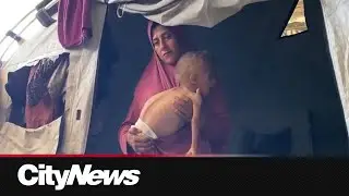 Gaza famine will threaten the lives of 132,000 children through June 2026