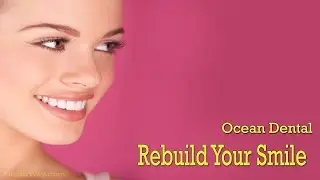 Full Mouth Reconstruction in Cancun Mexico - Ocean Dental