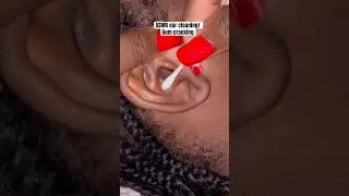 ASMR ear cleaning/Gum cracking #earcleaningasmr #asmrearcleaning