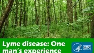 One Man's Experience with Lyme Disease