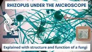 Rhizopus Nigricans (Bread mold) under the microscope | Fungi structure and function