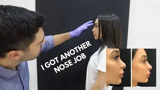 I DID MY NOSE..AGAIN