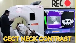 CECT NECK CONTRAST,Somatom.go