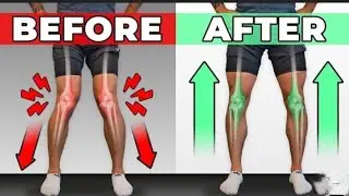 Knee Internal Rotation ! Get Straight leg in 30 days