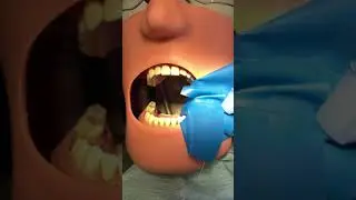 Root Canal Video: Chairside Assisting (Part II)