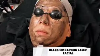Black doll Carbon Lazer (skin whitening) #nocopyrightmusicinfringementintended 
