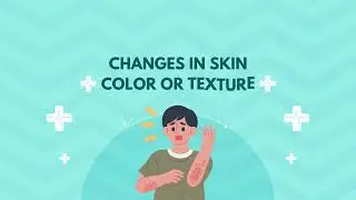 CRPS Symptoms You Might Not Know About 12-03-2023