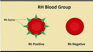 Rh blood group system, Rh antigen/ Rh factor