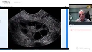 What happens in a typical IVF cycle? Why IVF might be right for you