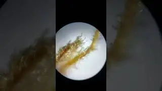 Cannabis trichomes at 100x magnification.