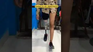 #artificiallimb #abovekneeamputee #belowkneeamputee #legprosthesis #handprosthesis #prosthetics