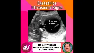 &ldquo;Keyhole Sign &mdash; The Sonographic Clue to Lower Urinary Tract Obstruction&rdquo;