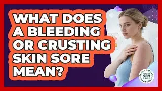 What does a bleeding or crusting skin sore mean?