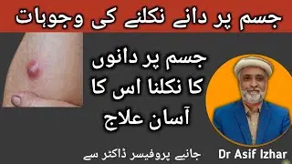 Skin Boils Treatment | Abscess Treatment | Phansi Phoro Ka Ilaj | Jism Par Bar Bar Dano Ka Nikalna