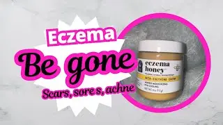 SKIN ISSUES BE GONE, MUST LISTEN 👂 ORDER ASAP ❣️