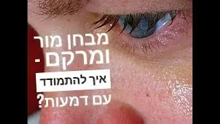 מבחן מור ומרקם - איך להתמודד עם דמעות?