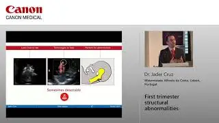 Dr Jader Cruz - First Trimester Structural Abnormalities