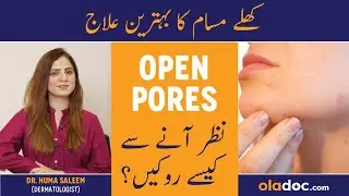 Large Open Pores On Face Treatment - Open Pores Khatam Karne Ki Home Remedy - Open Pores Ka Ilaj