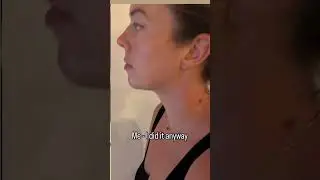 Deep Plane Neck Lift in Istanbul | Turkey Plastic Surgery Clinic