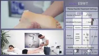ESWT MODUS Touch    Radial Shock Wave Therapy System
