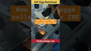 IVF Egg Retrieval by Embryologist #ivf #fertilitytreatment #ivfjourney #embryology #ivfsuccess