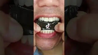 Satisfying ASMR TikTok drag&eacute;e candy 😋 #DoctorTristanPeh #TikTok #ASMR